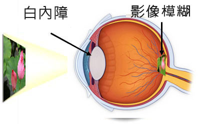 父爱如山，预约眼检送健康，给他看得见的爱