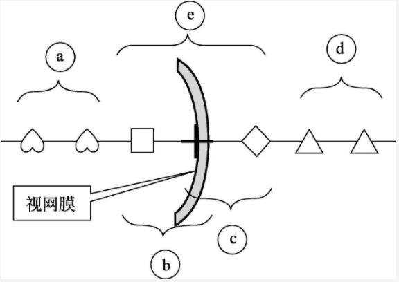 屈光不正的有哪几个种类？